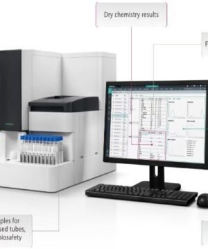 Automated Urinalysis System